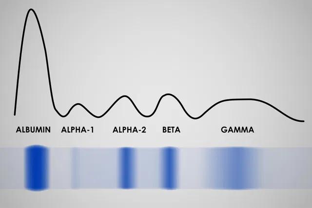 electroforesis grafica - Cómo interpretar resultados de electroforesis de proteínas