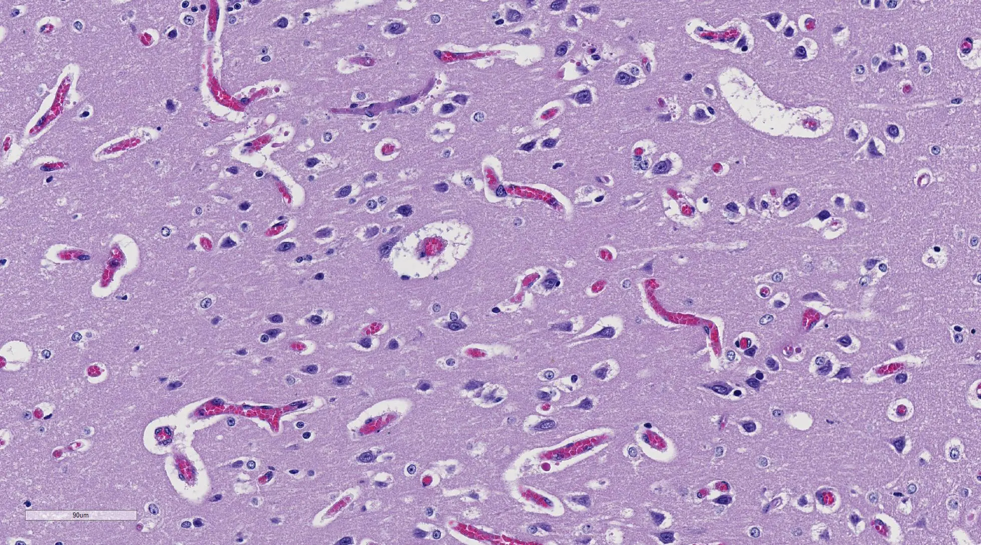 babesia bovis imprenta cerebral - Cómo se cura la piroplasmosis bovina