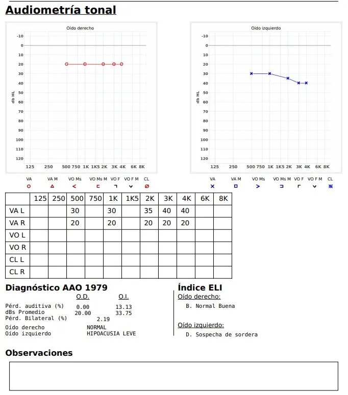 como se lee una grafica de audiometria - Cómo se lee un audiograma