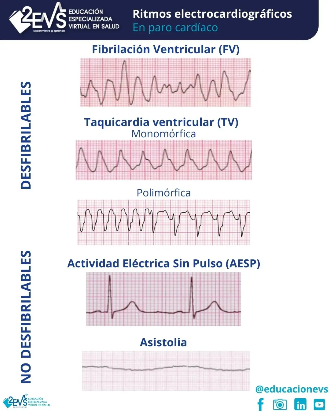 como se grafica el ritmo - Cómo se marca el ritmo