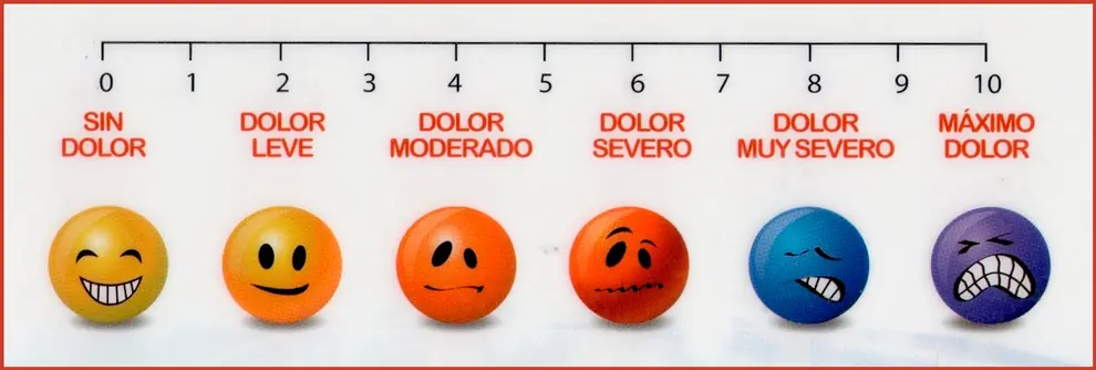 grafica del dolor - Cómo se miden los niveles de dolor