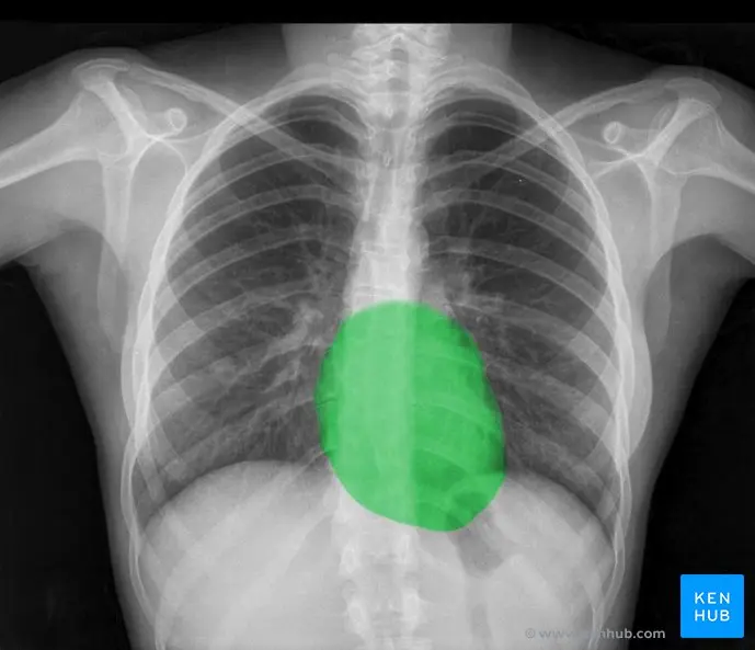 a puro pulmon grafica - Cómo se ve una imagen de pulmones sanos