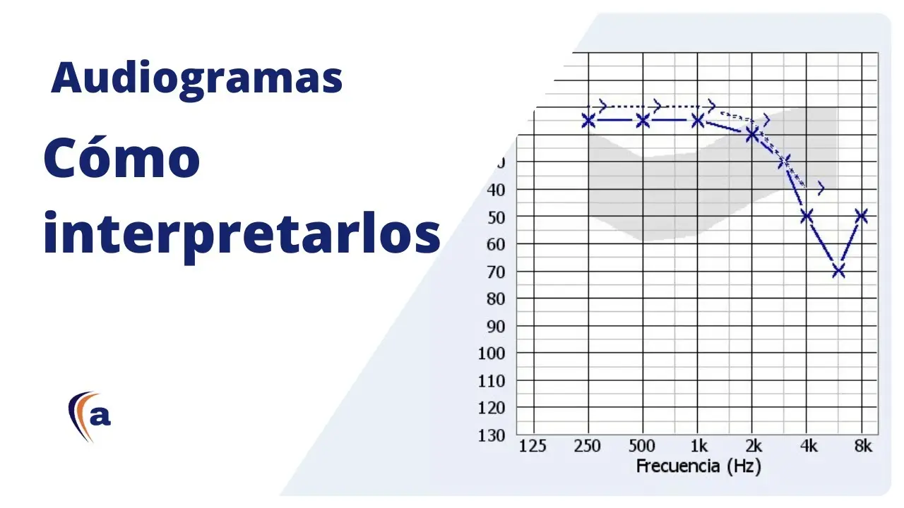 audiometria grafica - Cuáles son los 3 tipos de pérdida auditiva