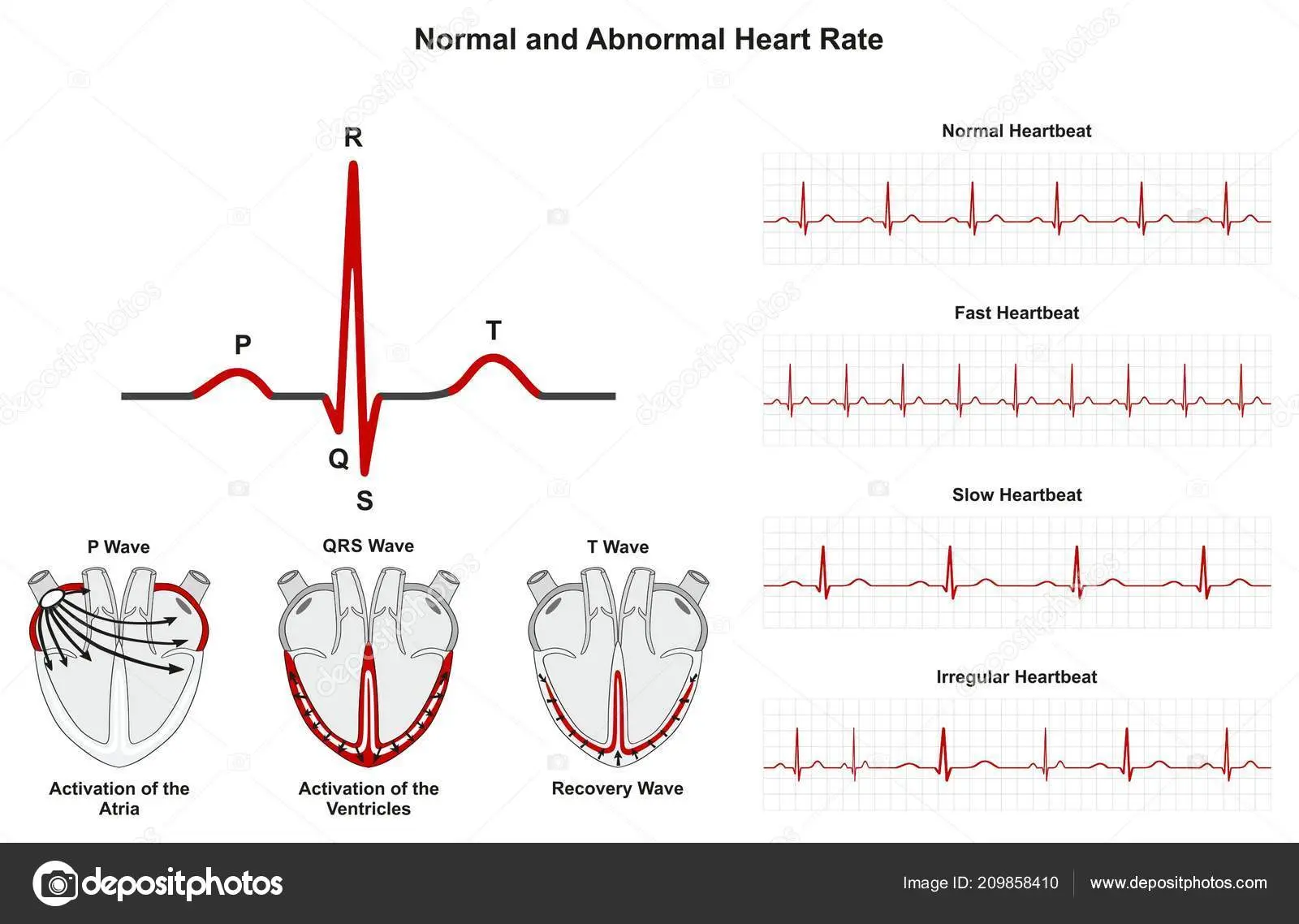 grafica ritmo cardiaco - Cuándo hay que alarmarse en los latidos del corazón