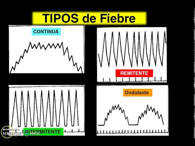 fiebre continua grafica - Cuánto dura la fiebre continua