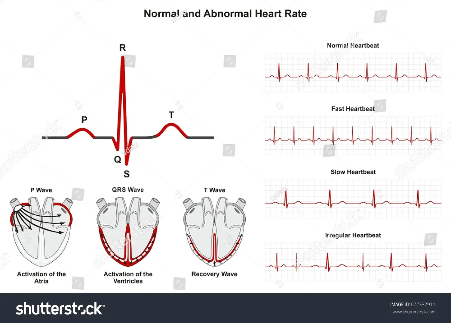 grafica de frecuencia cardiaca - Cuántos bpm es normal por edad