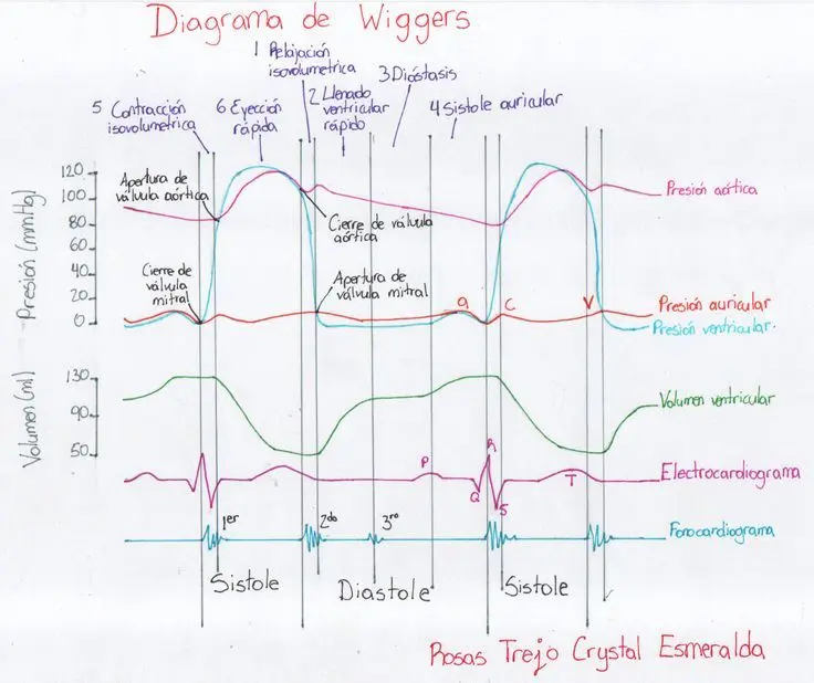 grafica de wiggers - Qué es la diastasis en el corazón