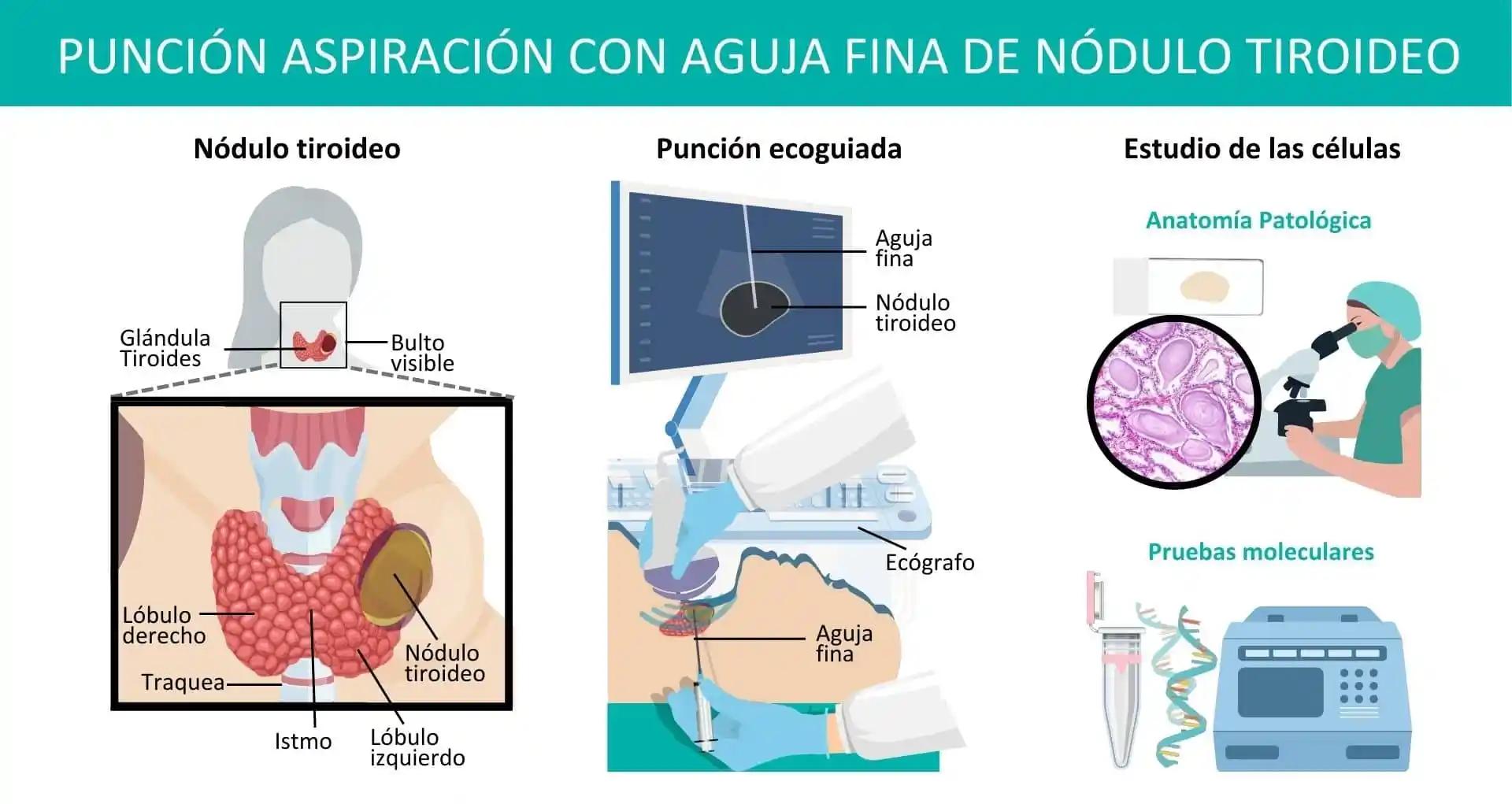 como hacer grafica de nodulos - Qué es un nodo en un diagrama