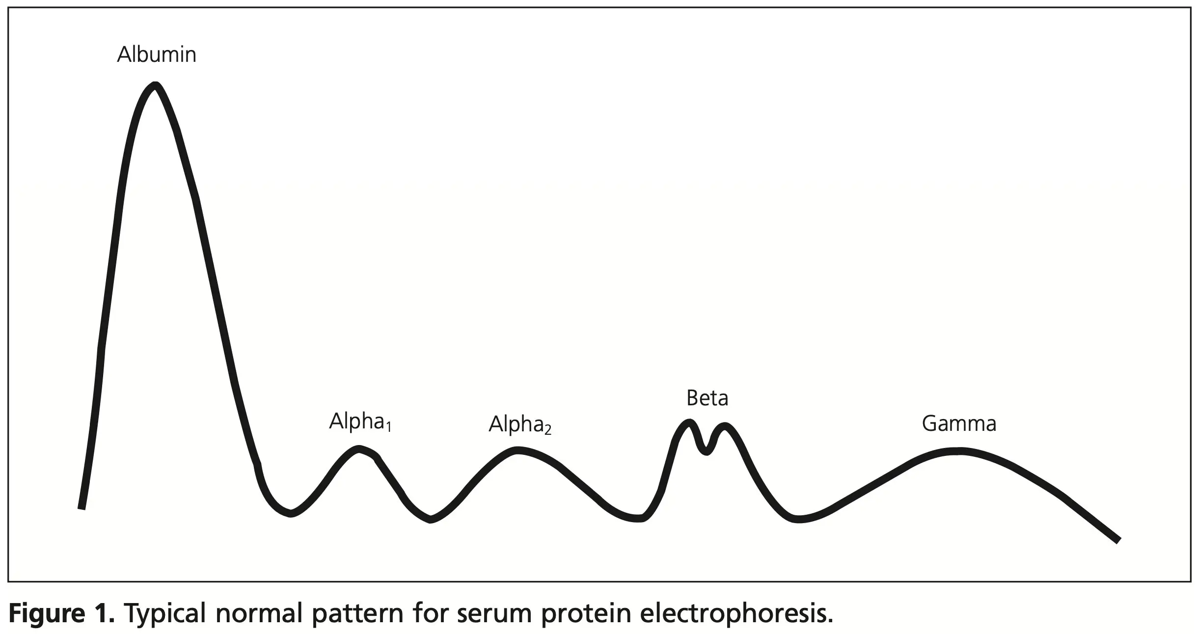 electroforesis grafica - Qué es y para qué sirve el electroforesis