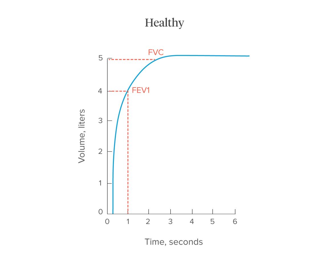 espirometria normal grafica - Qué le indica la relación FEV1 CVF de un paciente cuyo resultado es de 78 %