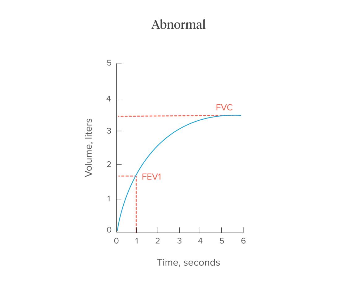 espirometria normal grafica - Qué significan FEV1 y FVC